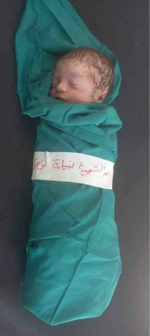 اضغط على الصورة لعرض أكبر. 

الإسم:	WhatsApp Image 2023-10-15 at 1.48.08 PM.jpg 
مشاهدات:	257 
الحجم:	59.9 كيلوبايت 
الهوية:	992385