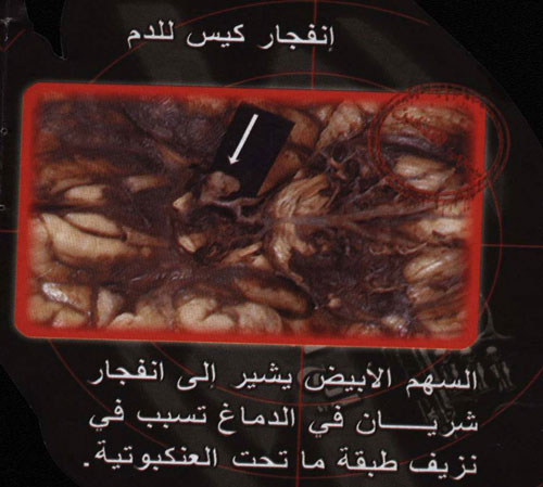 اضغط على الصورة لعرض أكبر.&nbsp;

الإسم:	uuuuu.jpg&nbsp;
مشاهدات:	1&nbsp;
الحجم:	48.9 كيلوبايت&nbsp;
الهوية:	851963