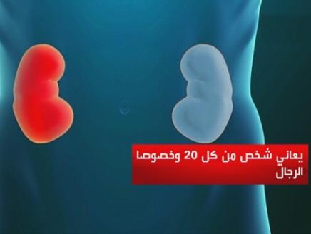 اضغط على الصورة لعرض أكبر.&nbsp;

الإسم:	436x328_23442_154498.jpg&nbsp;
مشاهدات:	1&nbsp;
الحجم:	11.0 كيلوبايت&nbsp;
الهوية:	847335