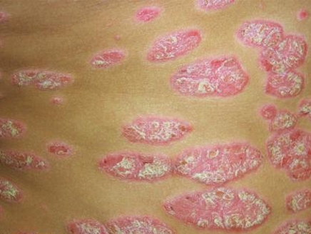 اضغط على الصورة لعرض أكبر.&nbsp;

الإسم:	436x328_80326_209043.jpg&nbsp;
مشاهدات:	1&nbsp;
الحجم:	99.2 كيلوبايت&nbsp;
الهوية:	849155