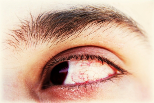 اضغط على الصورة لعرض أكبر.&nbsp;

الإسم:	eye-JPG_095627.jpg&nbsp;
مشاهدات:	1&nbsp;
الحجم:	128.8 كيلوبايت&nbsp;
الهوية:	849127