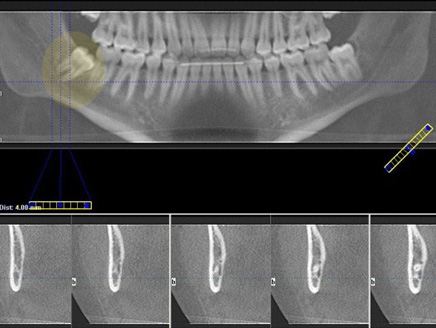 اضغط على الصورة لعرض أكبر.&nbsp;

الإسم:	436x328_45913_206668.jpg&nbsp;
مشاهدات:	1&nbsp;
الحجم:	79.4 كيلوبايت&nbsp;
الهوية:	849154
