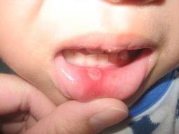 اضغط على الصورة لعرض أكبر.&nbsp;

الإسم:	info5314.jpg&nbsp;
مشاهدات:	2&nbsp;
الحجم:	5.9 كيلوبايت&nbsp;
الهوية:	848571