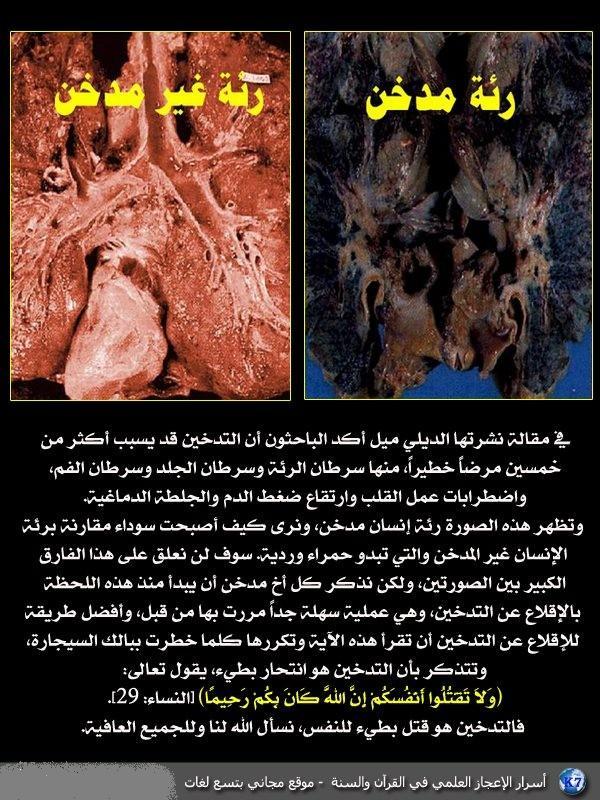 اضغط على الصورة لعرض أكبر.&nbsp;

الإسم:	4cf7f4f03ab476335b8024d1c76377d4.jpg&nbsp;
مشاهدات:	1&nbsp;
الحجم:	117.7 كيلوبايت&nbsp;
الهوية:	852864