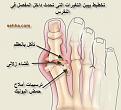 اضغط على الصورة لعرض أكبر. 

الإسم:	Gout08.jpg 
مشاهدات:	18205 
الحجم:	23.7 كيلوبايت 
الهوية:	825990