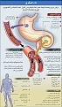 اضغط على الصورة لعرض أكبر. 

الإسم:	diabetes-summary.jpg 
مشاهدات:	74091 
الحجم:	68.3 كيلوبايت 
الهوية:	844490