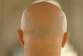 اضغط على الصورة لعرض أكبر. 

الإسم:	imagesCAS2EB39.jpg 
مشاهدات:	1023 
الحجم:	2.9 كيلوبايت 
الهوية:	845038